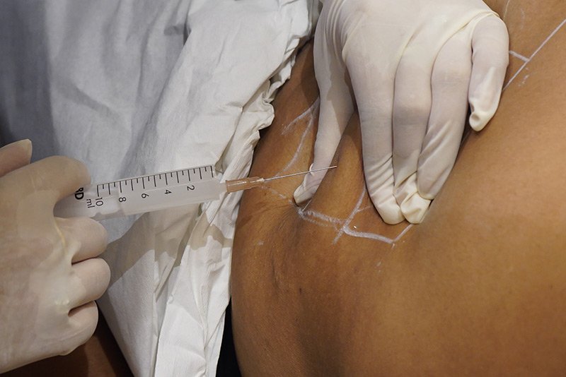 Aqualyx fat dissolving injections