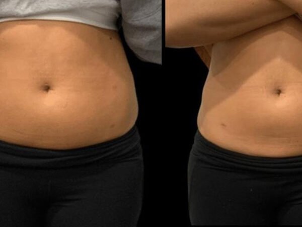 Lemon-Bottle-Before-After-4