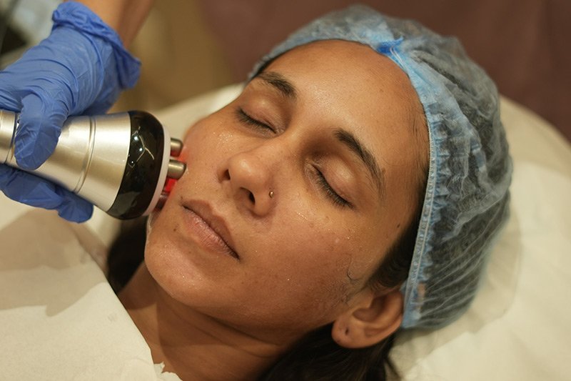 Radio Frequency Fat Melting