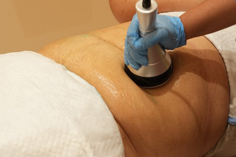 Ultrasonic cavitation Treatments